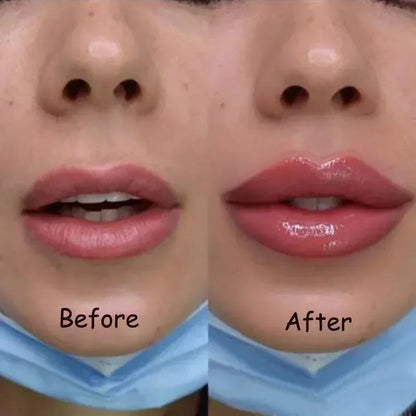 Fuller Lips Zonder Fillers – Direct Plumping Effect | Vegan & Dermatologisch Getest